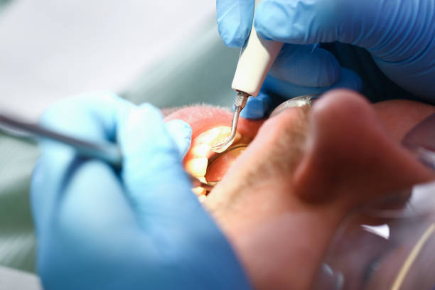 Best Broken or Cracked Tooth Emergency Dentist in Holiday Heights, NJ