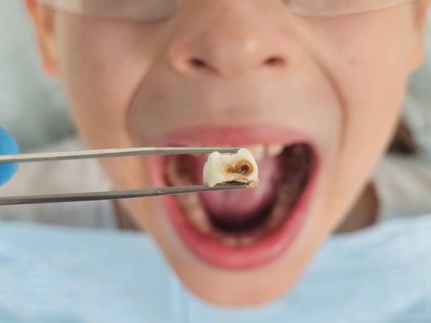 Best Broken or Cracked Tooth Emergency Dentist in Holiday Heights, NJ